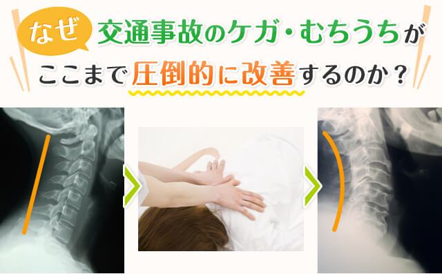 なぜ交通事故のケガ・むちうちがここまで圧倒的に改善するのか